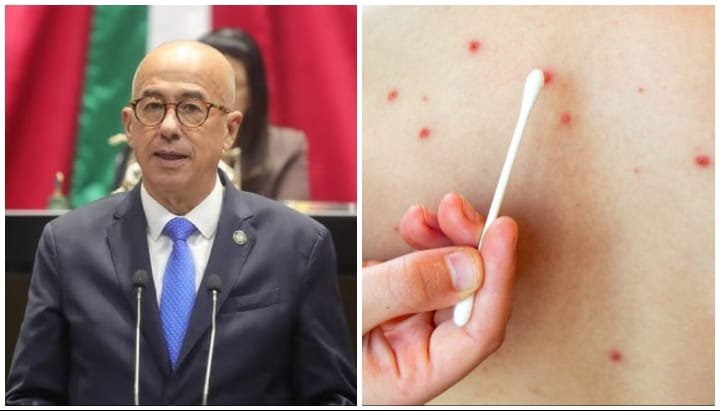Cuestiona PAN control de brote de sarampión en México por parte de Salud