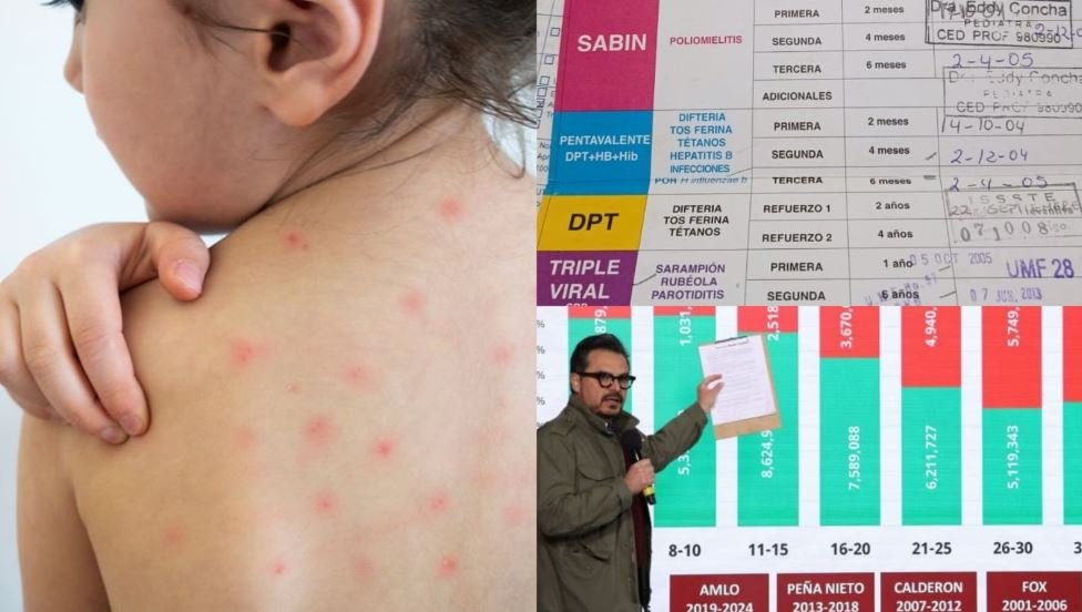 Tunden a Robledo por culpar al PRI y PAN de falta de vacunación contra sarampión aunque los más afectados son niños