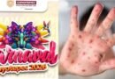 Municipios del EdoMéx comienzan a cancelar festivales y carnavales por brote de sarampión