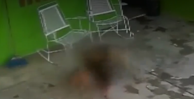 Niña es sometida a cirugía tras ataque de perro en Coahuila 